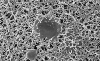 Mucus with microbe