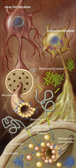 neuronImage